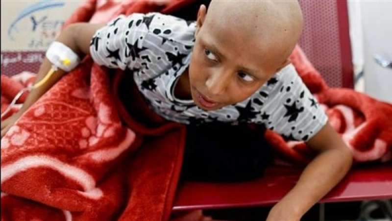 أطفال مصابون بالسرطان في اليمن