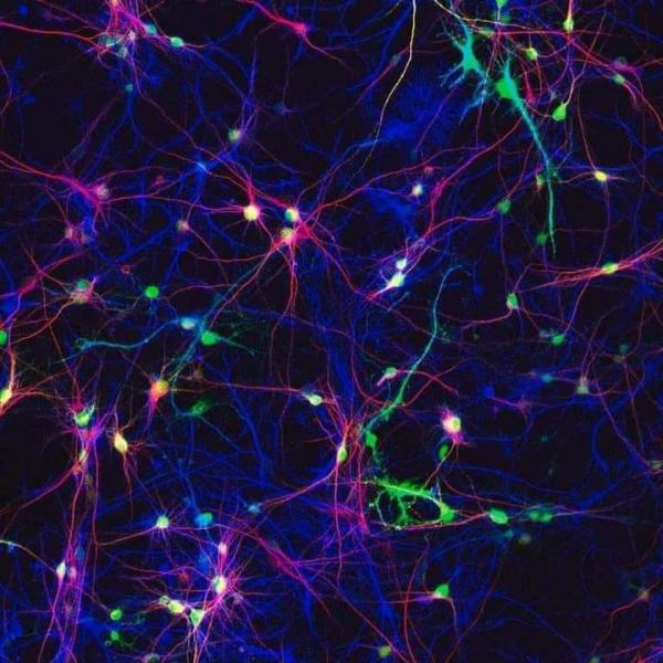 خلايا المخ