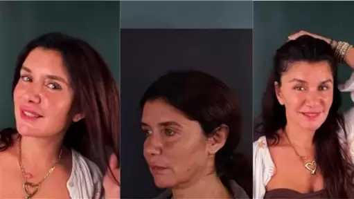 بإطلالة لافتة.. غادة عادل تكشف لأول مرة نتيجة عملية التجميل (فيديو)